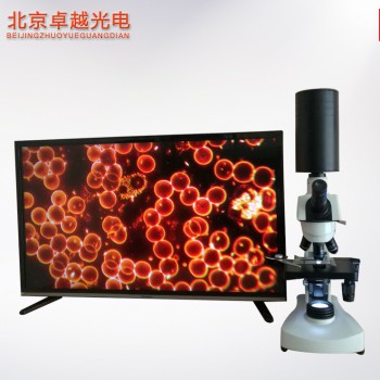 北京卓越  黑背景高清一滴血检测仪 细胞分析仪