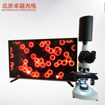 北京卓越  黑背景一滴血检测仪 细胞分析仪生物显微镜